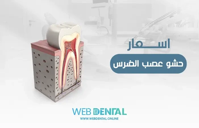 اسعار حشو عصب الضرس image