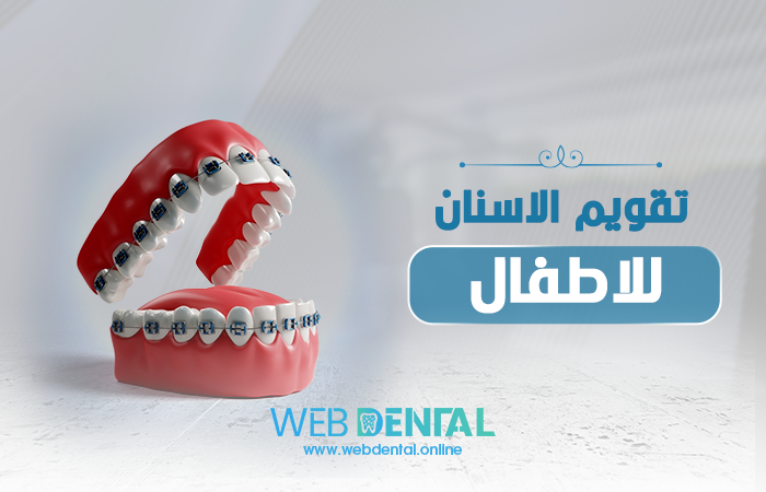 تقويم الاسنان للاطفال image